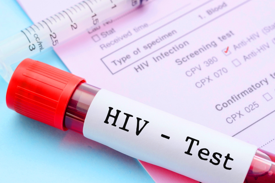 Contagio Hiv un uomo a processo per aver consapevolmente contagiato la moglie