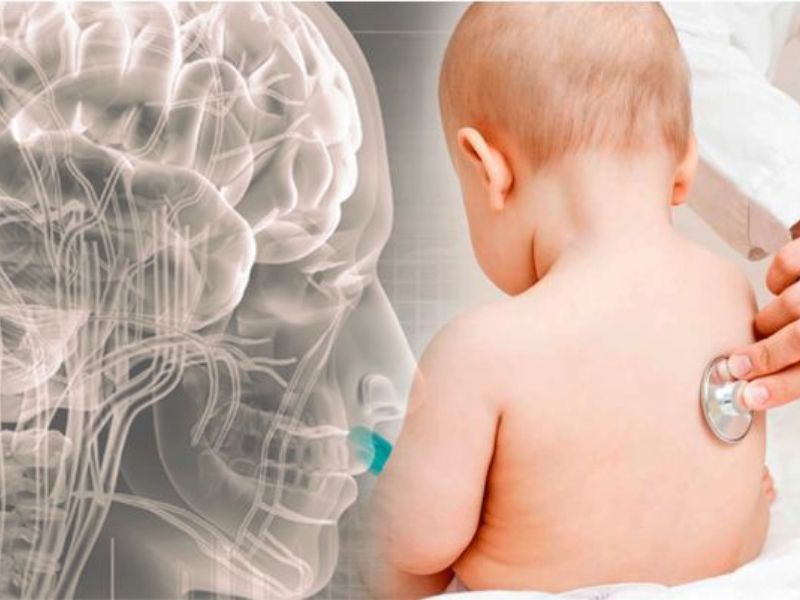 La neurologia pediatrica al San Matteo