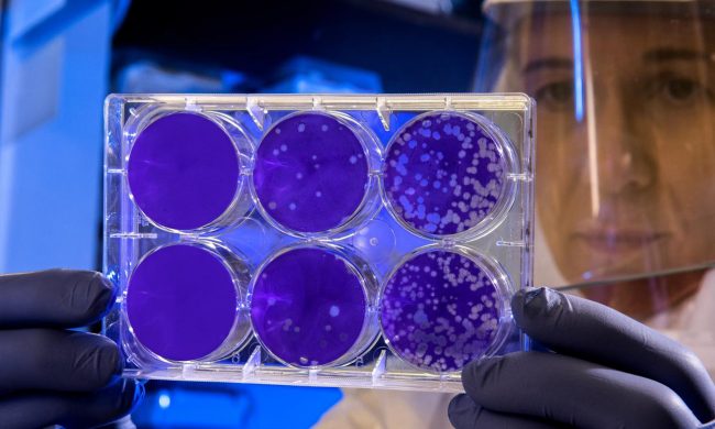 Tamponi in 60 minuti invece di 7 ore, lo studio completato al San Matteo di Pavia