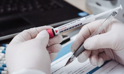 Test sierologici, arrivano i primi risultati: più persone in quarantena di quante effettivamente contagiate