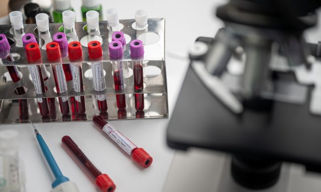 Coronavirus, plasma dei guariti per curare i malati: sperimentazione conclusa