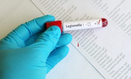 Allarme legionella in Brianza: morto un anziano. Dopo il Covid l'altro nemico dei polmoni