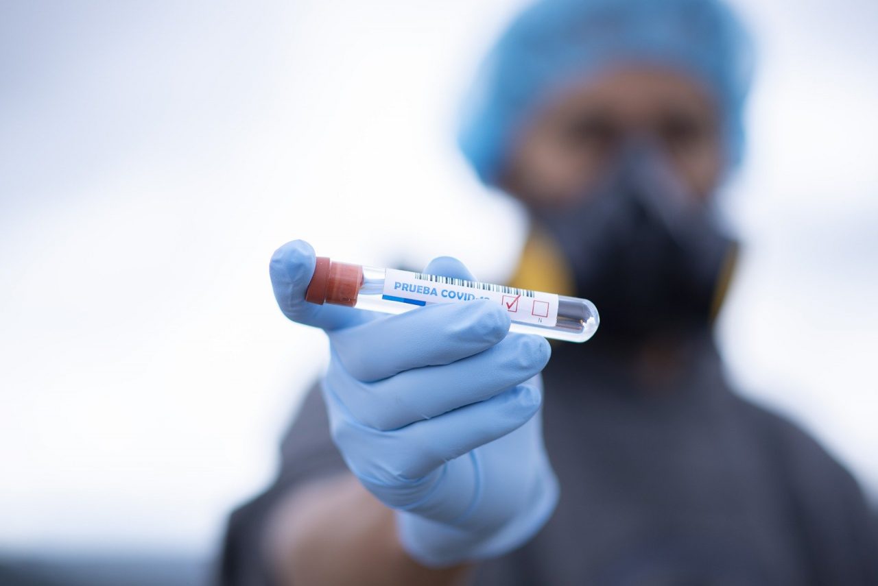 Coronavirus: ultimi aggiornanti dalla Regione: a Pavia e provincia 5.252 positivi (+23)