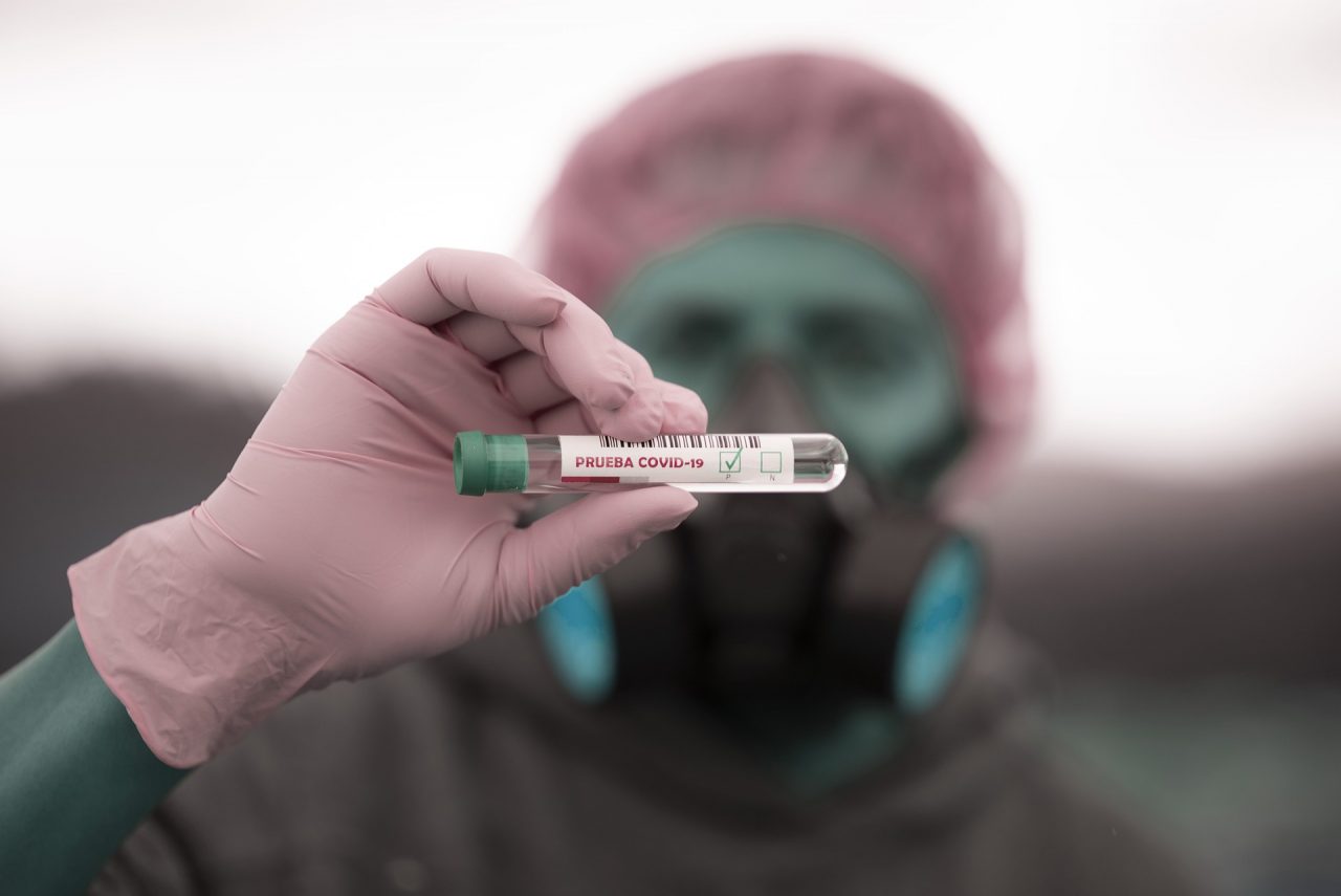 Coronavirus, 5.404 positivi: la situazione a Pavia e provincia domenica 7 giugno 2020