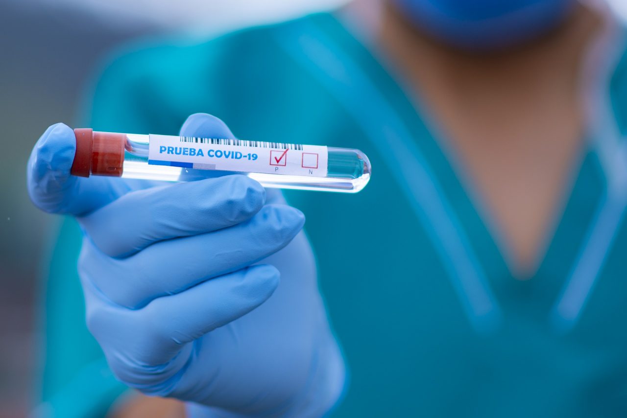 Coronavirus, 5.533 positivi: la situazione a Pavia e provincia domenica 21 giugno 2020