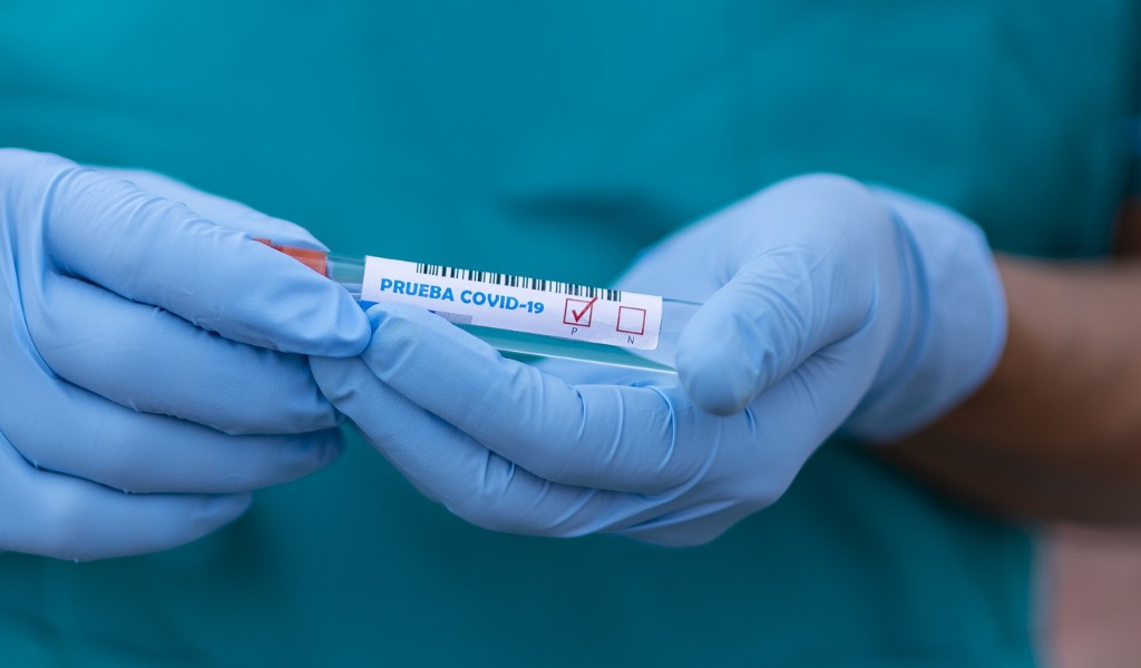 Coronavirus Lombardia, 244 nuovi positivi: a Pavia e provincia sono 5.485 (+13)