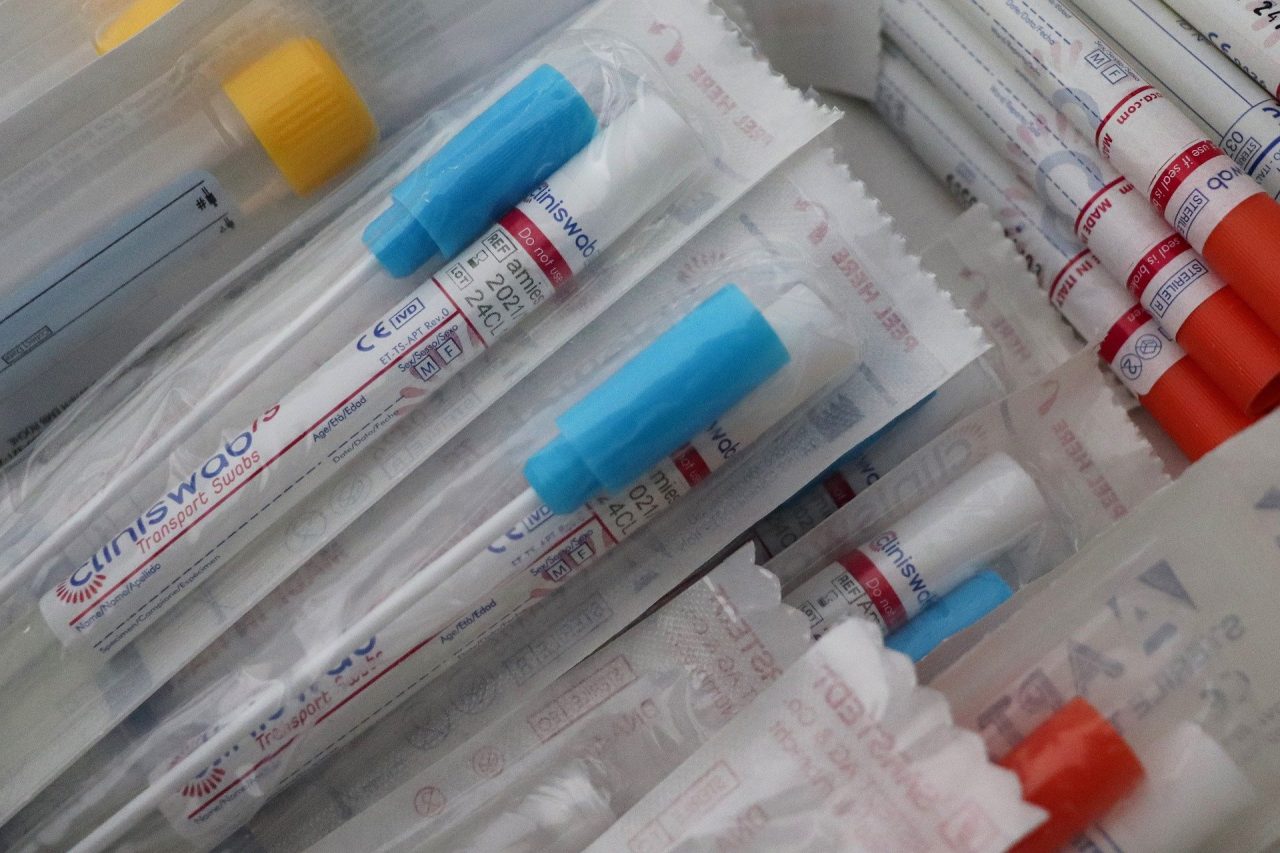 Covid, in Pronto Soccorso arrivano i test antigenici rapidi: risultati in 15 minuti