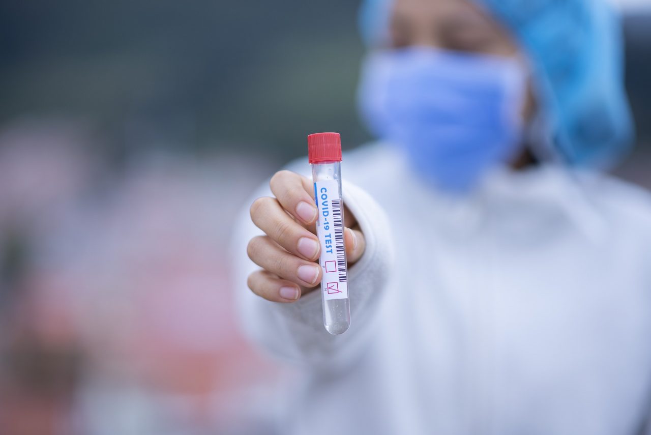 Coronavirus, gli ultimi aggiornamenti da Regione: a Pavia e provincia 5.151 positivi (+46)
