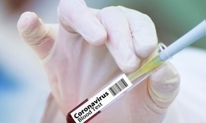 La lotta al Covid-19 passa dal plasma: Avis in campo per i test sierologici ai donatori