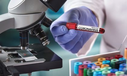 Coronavirus: cosa significa "debolmente positivi"? C'è da preoccuparsi?