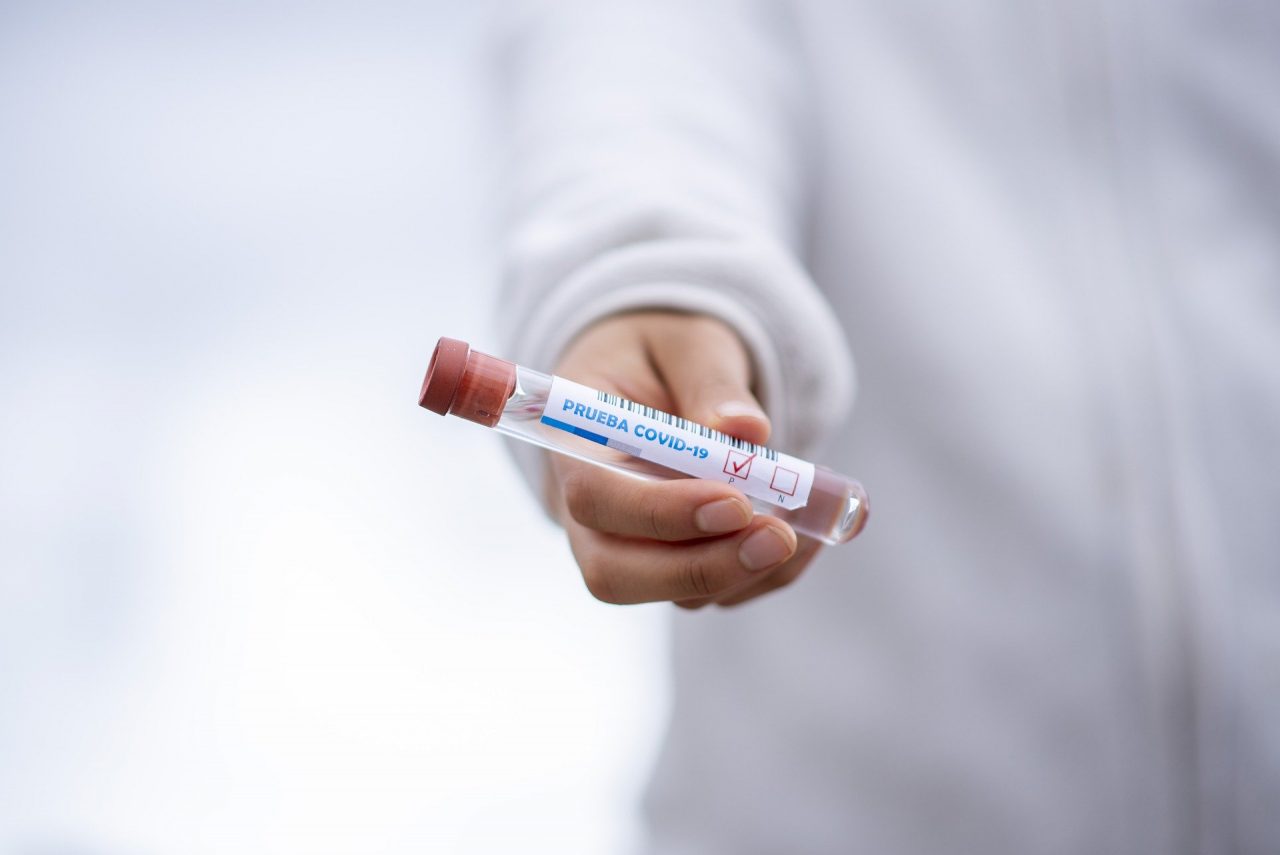 Coronavirus, 128 nuovi positivi in Lombardia. A Pavia e Provincia 5.542 (+9)