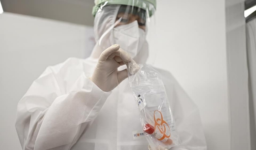 Covid, dati 15 aprile 2021 | +2.722 positivi in Lombardia | Pavia +143