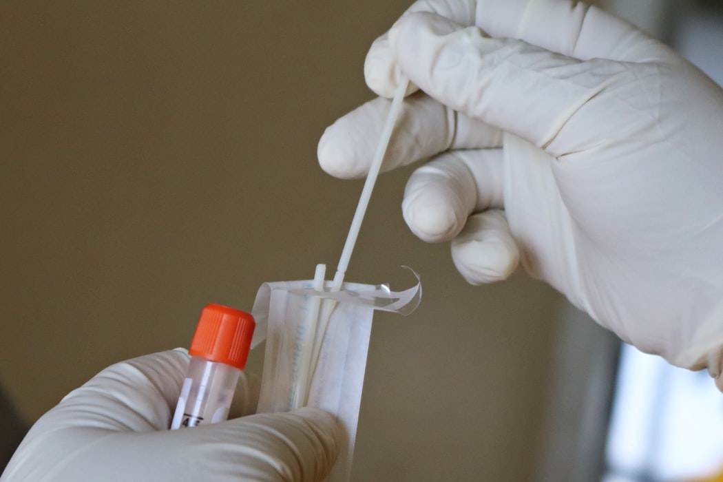 Anche i medici di base potranno effettuare i tamponi rapidi antigenici