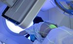 Radioterapia pre-trapianto nei pazienti con leucemia: la tecnica per risparmiare i tessuti sani