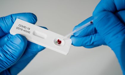Test sierologici, il Consiglio di Stato legittima l'accordo tra San Matteo di Pavia e Diasorin