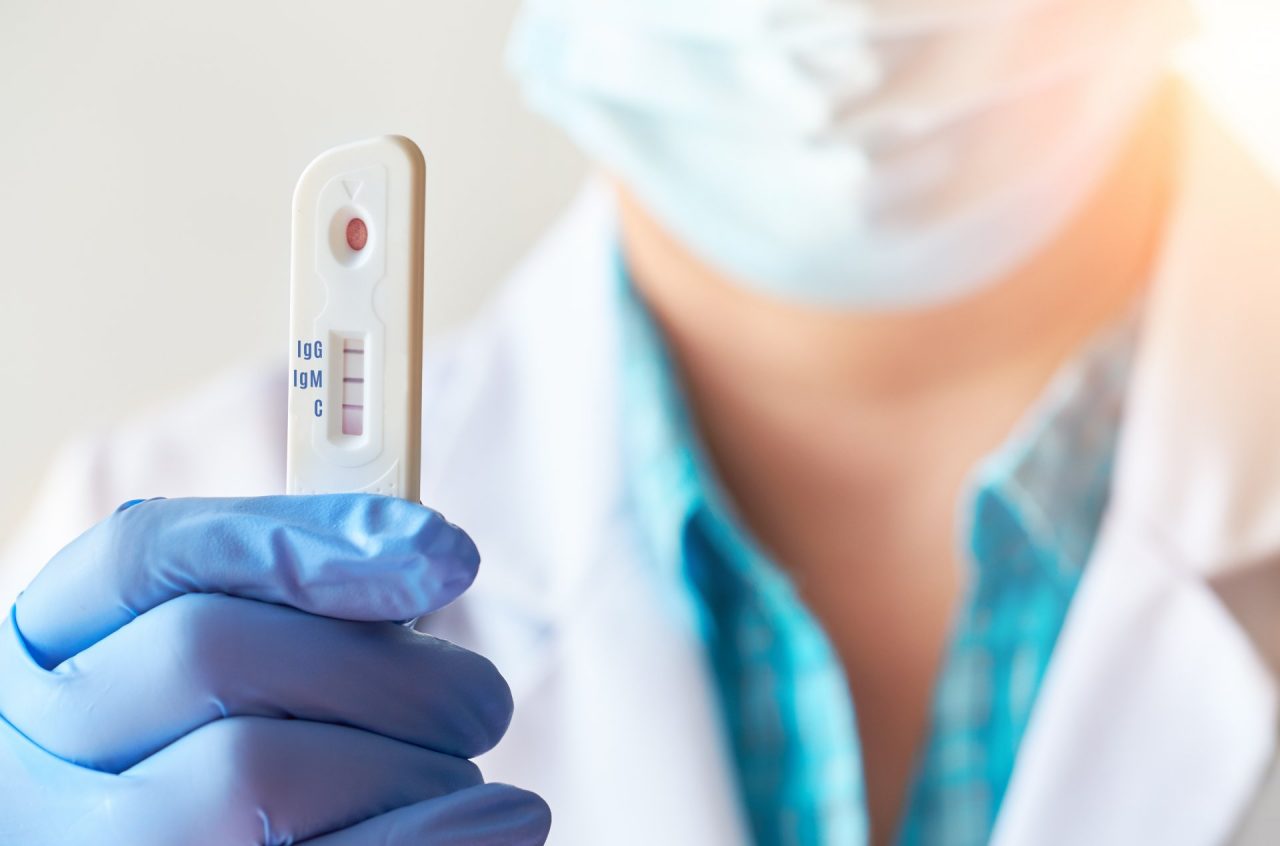 A Pavia tamponi rapidi gratuiti per studenti e personale scolastico anche nelle farmacie