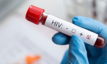 A Pavia counseling e test gratuiti per la ricerca del virus dell'Hiv