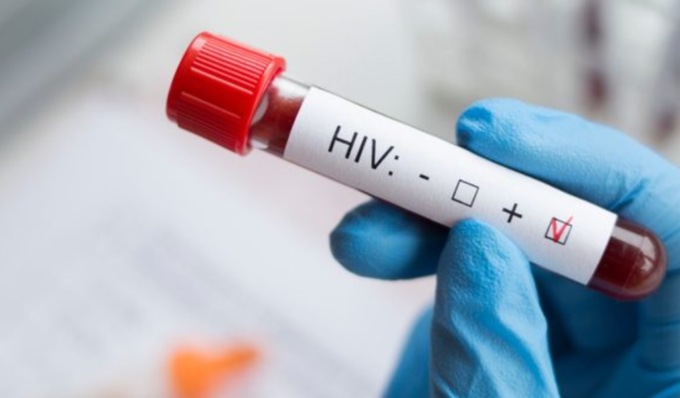 A Pavia counseling e test gratuiti per la ricerca del virus dell’Hiv