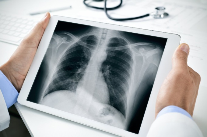 Al via il progetto pilota di Radiologia Domiciliare nell’Oltrepò Pavese