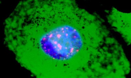 Il Covid danneggia il DNA e causa invecchiamento cellulare: la scoperta dei ricercatori di Pavia