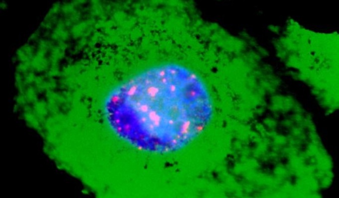Il Covid danneggia il DNA e causa invecchiamento cellulare: la scoperta dei ricercatori di Pavia