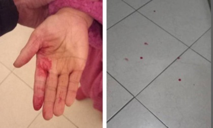 Voghera, massaggiatrice aggredita e rapinata nella notte: ferita alle mani con un coltello