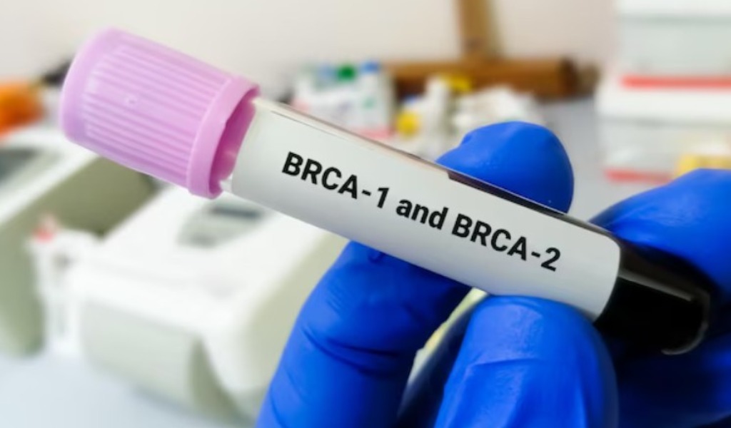 Trent’anni dalla scoperta dei geni BRCA: Pavia celebra una rivoluzione nella prevenzione oncologica