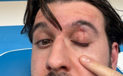 Aggressione al direttore tecnico della Folgore Caratese durante la partita contro il Pavia Calcio