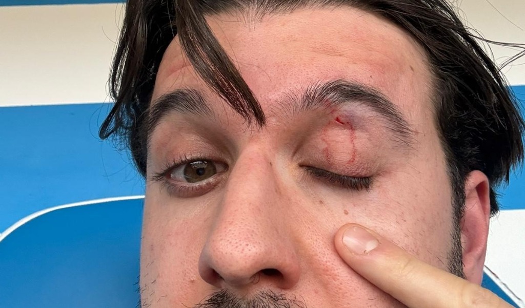 Aggressione al direttore tecnico della Folgore Caratese durante la partita contro il Pavia Calcio