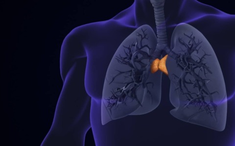 Tumori del timo, Pavia fa rete: la nuova alleanza tra San Matteo e Mondino per diagnosi e cure veloci