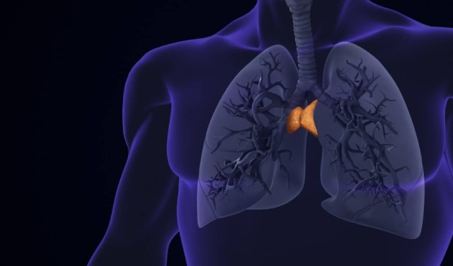 Tumori del timo, Pavia fa rete: la nuova alleanza tra San Matteo e Mondino per diagnosi e cure veloci